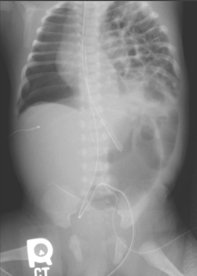 Image 5b
