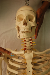 fig 11a