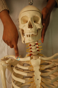 fig 14a